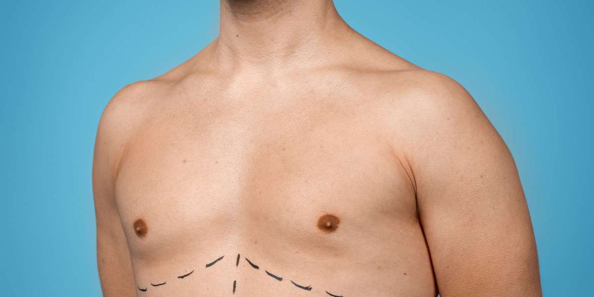 Six Pack Surgery Clinic in Istanbul With Travel Step and Cost Info