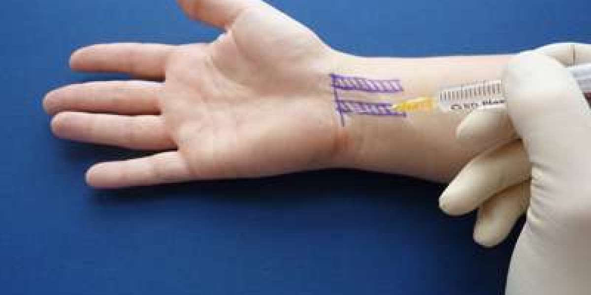 Understanding Carpal Tunnel Injections | A Complete Guide to Relief and Recovery