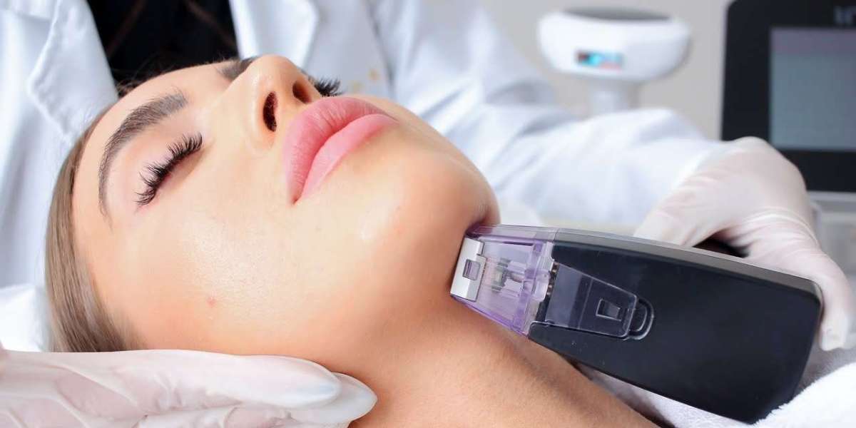 Empowering Women’s Wellness | The Transformative Benefits of Morpheus 8v